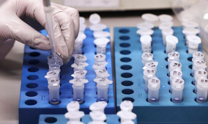 Casos oficiais de coronavírus estão defasados em São Carlos