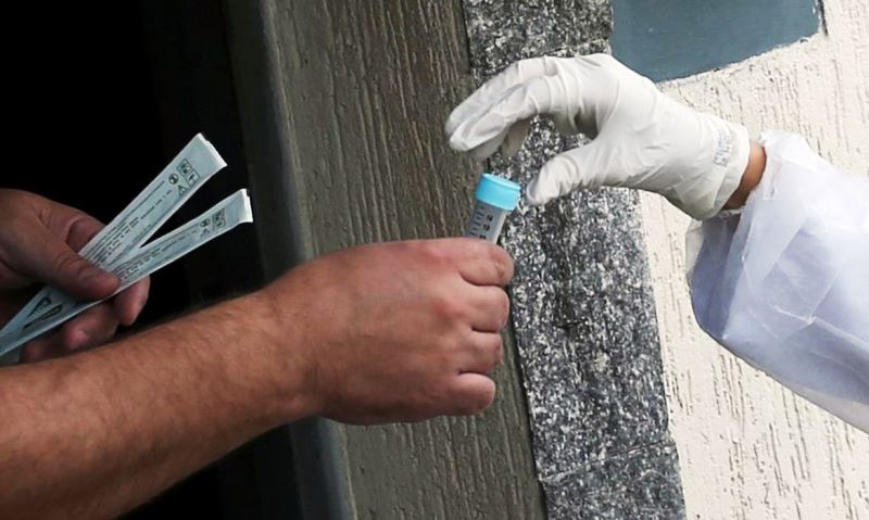 Camex zera imposto de importação de 118 produtos contra coronavírus