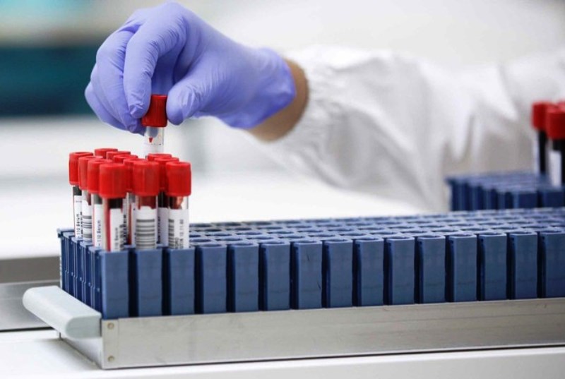 Hapvida inicia testagem sorológica para o novo coronavírus