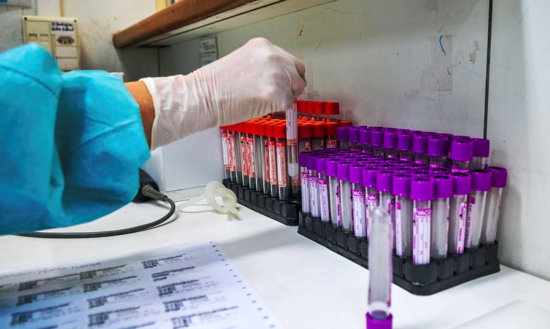 Trombose em pequenos vasos é característica de Covid-19