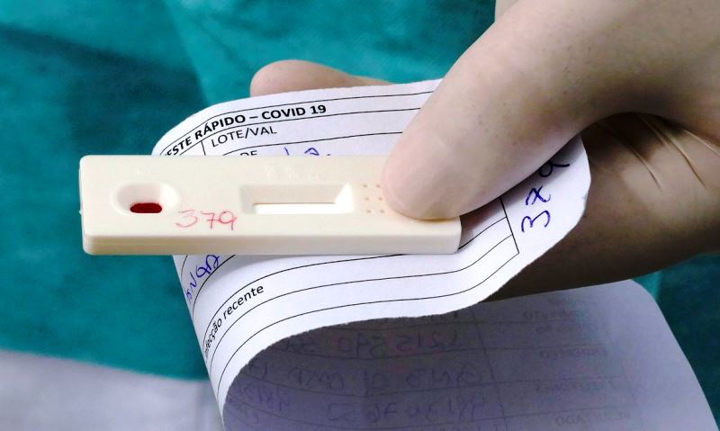 SP fará teste para avaliar circulação da Covid-19 na rede estadual