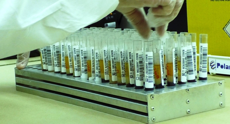 Anti-inflamatório colchicina acelera recuperação de pacientes hospitalizados com Covid-19