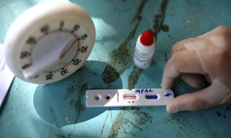 Butantan oferece testagem gratuita de Covid-19 na capital paulista