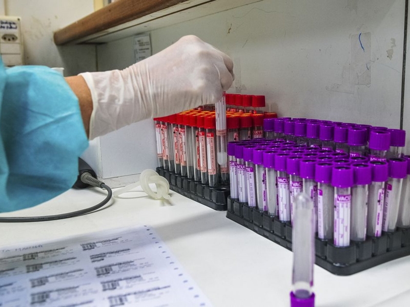 Pesquisa quer voluntários para saber relação entre genética e Covid-19