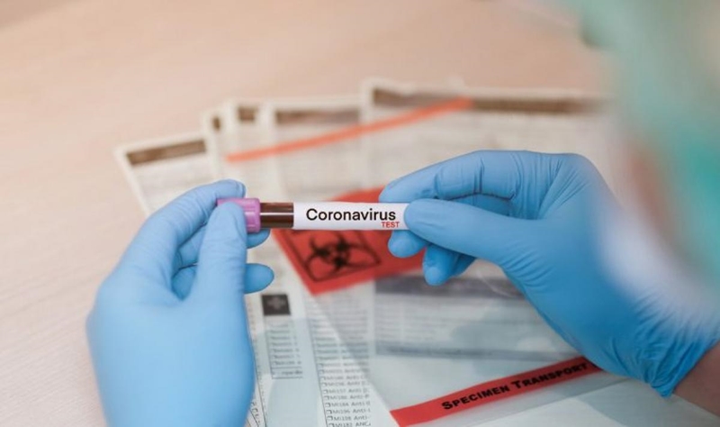 São Carlos atinge 1.771 casos confirmados de Covid-19