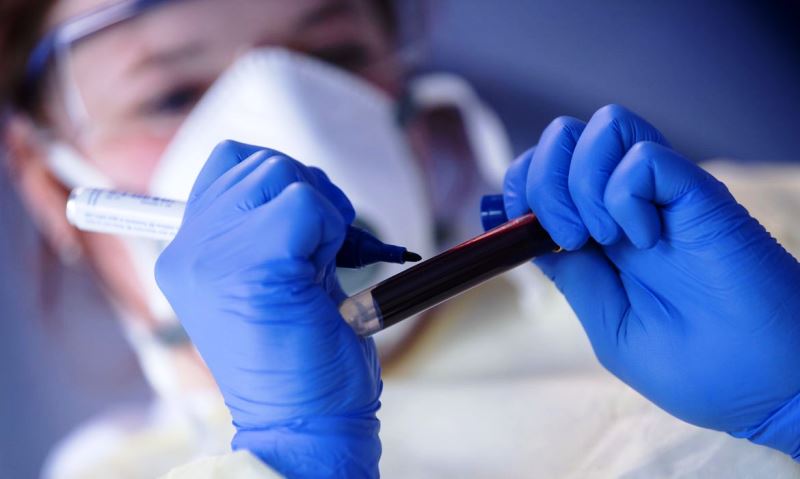 São Carlos contabiliza mais 13 casos positivos da Covid-19