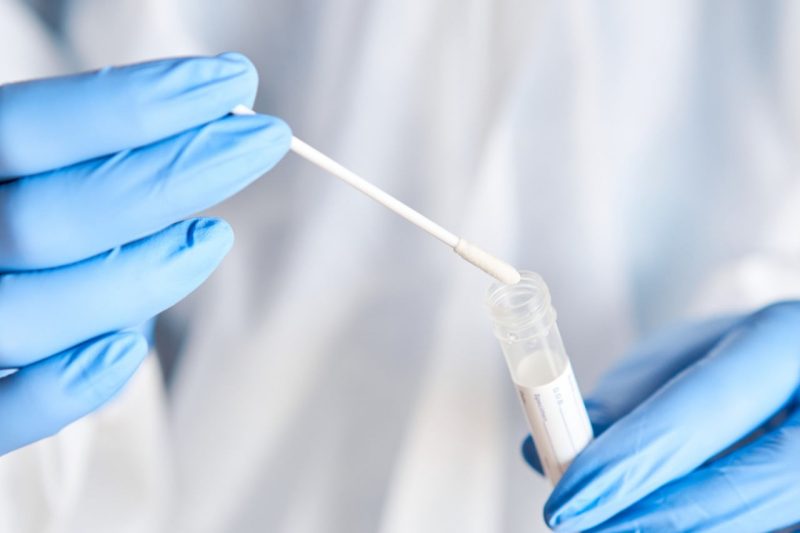 São Carlos recebe mais de 13 mil testes de Covid19