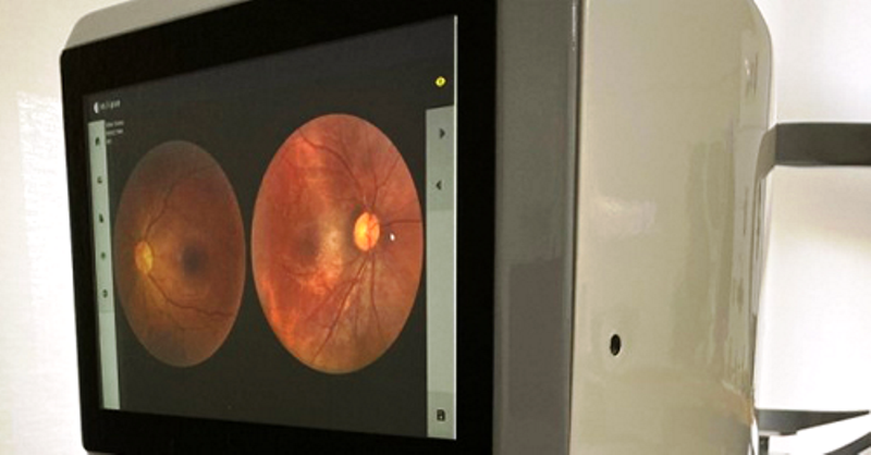 Novo tipo de retinógrafo tem custo aproximado cinco vezes menor que os vendidos no mercado