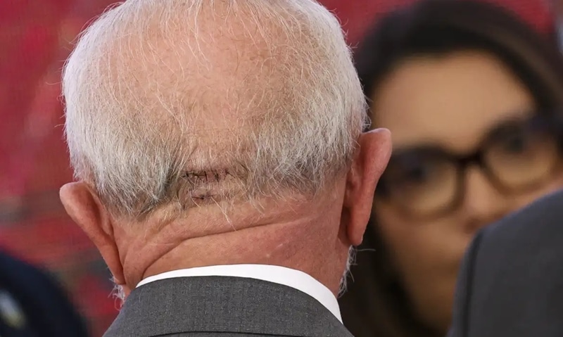 Cirurgia de Lula é destaque